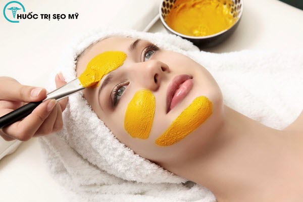 Trị sẹo bằng phương pháp tự nhiên, đơn giản, dễ thực hiện